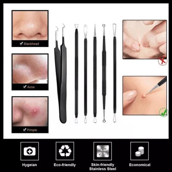 طقم أدوات إزالة الرؤوس السوداء والبثور 6 قطع مع علبة معدنية من إليسي (ELLESYE Blackhead Remover Kit)